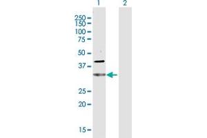 Western Blot analysis of CDC34 expression in transfected 293T cell line by CDC34 MaxPab polyclonal antibody. (CDC34 Antikörper  (AA 1-236))