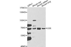 Western blot analysis of extracts of various cell lines, using LBR antibody (ABIN5973181) at 1/1000 dilution. (Lamin B Receptor Antikörper)