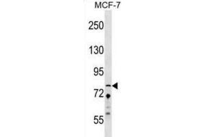 Western Blotting (WB) image for anti-Zinc Finger Protein 828 (ZNF828) antibody (ABIN2999729) (ZNF828 Antikörper)