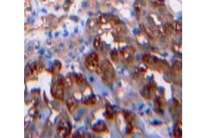 Used in DAB staining on fromalin fixed paraffin-embedded Kidney tissue (Leptin Antikörper  (AA 22-167))