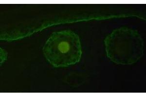 Immunofluorescence staining of Collagen type XVII alpha 1 chain with Cat. (COL17A1 Antikörper  (Chain alpha 1))