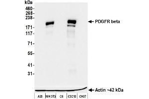 Western Blotting (WB) image for anti-Platelet Derived Growth Factor Receptor beta (PDGFRB) antibody (ABIN7795629)