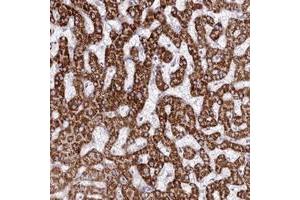Immunohistochemical staining of human liver with CEP164 polyclonal antibody  shows strong cytoplasmic positivity in hepatocytes.