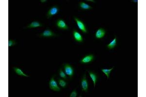 Immunofluorescence staining of A549 cells with ABIN7144797 at 1:133, counter-stained with DAPI. (ATXN7 Antikörper  (AA 402-503))
