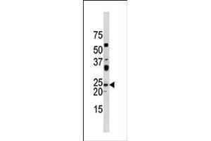 Image no. 1 for anti-Cyclin-Dependent Kinase Inhibitor 1A (p21, Cip1) (CDKN1A) (pThr57) antibody (ABIN358182) (p21 Antikörper  (pThr57))