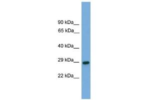 WB Suggested Anti-RGS19 Antibody Titration: 0. (RGS19 Antikörper  (N-Term))
