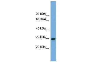 WB Suggested Anti-RGS19 Antibody Titration: 0.