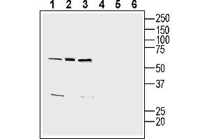Western blot analysis of human  monocytic leukemia cell line lysates (lanes 1 and 4), human  megakaryoblast cell line lysate (lanes 2 and 5) and human LNCaP prostate adenocarcinoma cell line lysate (lanes 3 and 6):1-3. (CD9 Antikörper  (Extracellular))