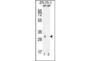 Western blot analysis of RAB40AL Antibdy (N-term) Cat. (RAB40AL Antikörper  (N-Term))