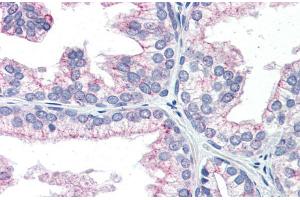 Human Prostate; Immunohistochemistry with Human Prostate lysate tissue at an antibody concentration of 5.