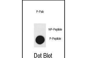 Dot blot analysis of anti-Phospho-KDR- Phospho-specific Pab (ABIN650847 and ABIN2839806) on nitrocellulose membrane. (VEGFR2/CD309 Antikörper  (pTyr1175))