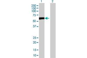 Western Blot analysis of ZBTB8 expression in transfected 293T cell line by ZBTB8 MaxPab polyclonal antibody. (ZBTB8A Antikörper  (AA 1-441))