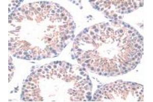 Detection of HPSE in Mouse Testis Tissue using Polyclonal Antibody to Heparanase (HPSE) (HPSE Antikörper  (AA 280-412))