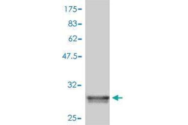 ZDHHC8 anticorps  (AA 1-42)