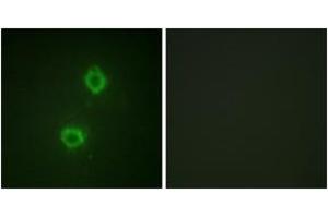 Immunofluorescence analysis of HuvEc cells, using FGFR1 (Ab-654) Antibody. (FGFR1 Antikörper  (AA 626-675))