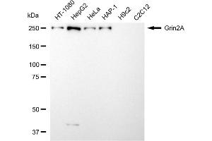 Western blotting analysis using grin2A antibody (ABIN7798740).