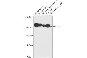Western blot analysis of extracts of various cell lines using ZAK Polyclonal Antibody at dilution of 1:3000.