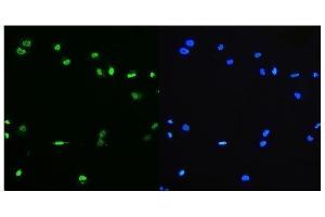 IF analysis of PTBP1 using anti-PTBP1 antibody (ABIN7599450). (PTBP1 Antikörper  (AA 1-504))