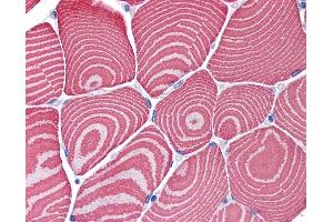 Immunohistochemistry (IHC) image for anti-Myosin Heavy Chain 7, Cardiac Muscle, beta (MYH7) (AA 1251-1300) antibody (ABIN6747193)