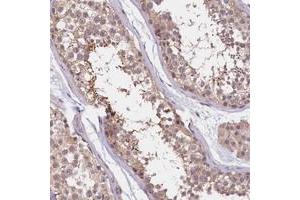 Immunohistochemical staining of human testis with UBXN6 polyclonal antibody  shows strong cytoplasmic positivity in spermatids. (UBXN6 Antikörper)