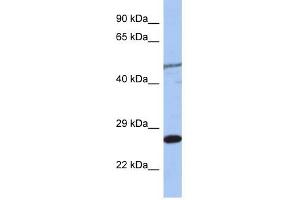 MIS12 antibody used at 1 ug/ml to detect target protein. (MIS12 Antikörper)