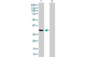 Western Blot analysis of COPS7B expression in transfected 293T cell line by COPS7B MaxPab polyclonal antibody. (COPS7B Antikörper  (AA 1-264))