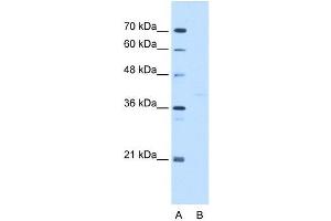 GMPPB antibody used at 5 ug/ml to detect target protein.