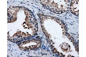 Immunohistochemical staining of paraffin-embedded liver tissue using anti-PSMC3mouse monoclonal antibody. (PSMC3 Antikörper)