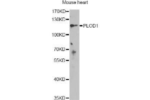Western blot analysis of extracts of mouse heart, using PLOD1 antibody (ABIN6289945) at 1:1000 dilution. (PLOD1 Antikörper)