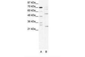 Image no. 1 for anti-T-Cell Acute Lymphocytic Leukemia 1 (TAL1) (AA 236-285) antibody (ABIN202266) (TAL1 Antikörper  (AA 236-285))