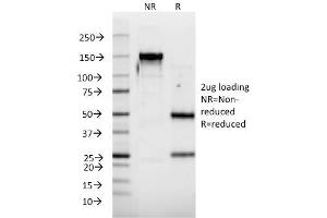SDS-PAGE Analysis Purified IFNA2 Mouse Monoclonal Antibody (N39). (IFNA2 Antikörper)