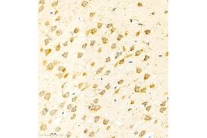 Immunohistochemistry (Paraffin-embedded Sections) (IHC (p)) image for anti-Eukaryotic Translation Initiation Factor 5A2 (EIF5A2) antibody (ABIN7073893)