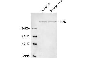 Western blot analysis of cell lysates using 1 µg/mL Rabbit Anti-Neurofilament-M Polyclonal Antibody (ABIN398865) The signal was developed with IRDyeTM 800 Conjugated Goat Anti-Rabbit IgG. (NEFM Antikörper  (AA 320-370))