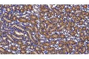 Immunohistochemistry (IHC) image for anti-Thioredoxin Reductase 1 (TXNRD1) (AA 374-577) antibody (ABIN7432433)