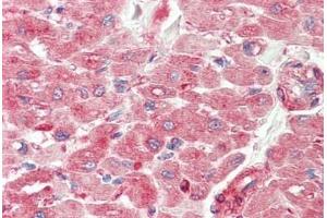 Human Heart: Formalin-Fixed, Paraffin-Embedded (FFPE) (TWEAK Antikörper  (Pro73))