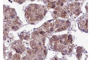 ABIN6267593 at 1/100 staining human liver tissue sections by IHC-P. (MEK1 Antikörper  (pSer217))
