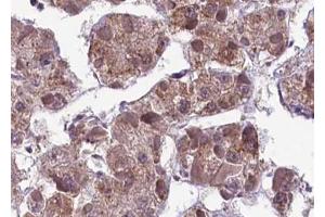 ABIN6267593 at 1/100 staining human liver tissue sections by IHC-P. (MEK1 Antikörper  (pSer217))