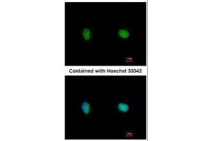 ICC/IF Image Immunofluorescence analysis of paraformaldehyde-fixed HeLa, using Ku70, antibody at 1:500 dilution. (XRCC6 Antikörper)