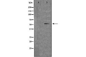 Western blot analysis of extracts from COLO cells, using OPN4 antibody. (OPN4 Antikörper  (C-Term))