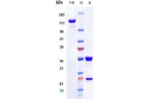 Anti-CEACAM5 / CEA / CD66e Reference Antibody (tusamitamab) on SDS-PAGE under reducing (R) condition. (Rekombinanter CEACAM5 (Tusamitamab Biosimilar) Antikörper)