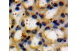 IHC-P analysis of Kidney tissue, with DAB staining. (Thyroperoxidase Antikörper  (AA 636-832))