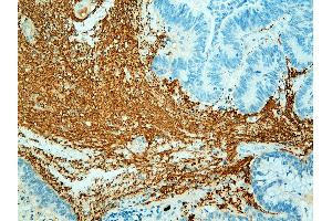 Immunohistochemistry (IHC) image for anti-Neurofilament 150, 200kD antibody (ABIN108435) (Neurofilament 150, 200kD Antikörper)