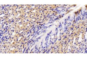 Immunohistochemistry (IHC) image for anti-Annexin A1 (ANXA1) (AA 6-346) antibody (ABIN7435880)