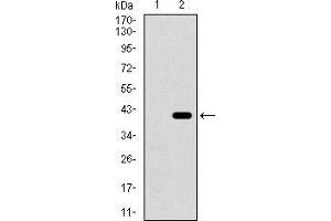 Western blot analysis using ITGA2B mAb against HEK293 (1) and ITGA2B (AA: 45-149)-hIgGFc transfected HEK293 (2) cell lysate. (Integrin Alpha2b Antikörper  (AA 45-149))