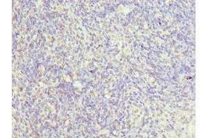Immunohistochemistry of paraffin-embedded human thymus tissue using ABIN7147523 at dilution of 1:100 (CHMP2B Antikörper  (AA 1-213))