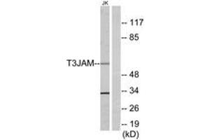 Western blot analysis of extracts from Jurkat cells, using T3JAM Antibody. (TRAF3IP3 Antikörper  (AA 251-300))