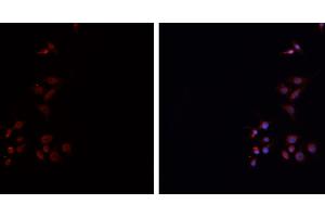 ABIN6276738 staining HEPG2 cells by IF/ICC.
