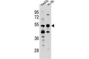 TEKT5 Antibody (Center) western blot analysis in HepG2,HL-60 cell line lysates (35 µg/lane). (TEKT5 Antikörper  (Middle Region))