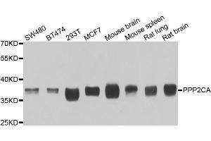 Western blot analysis of extracts of various cell lines, using PPP2CA antibody. (PPP2CA Antikörper)