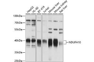 Western blot analysis of extracts of various cell lines, using NDUF antibody (123) at 1:1000 dilution. (NDUFA10 Antikörper  (AA 36-300))
